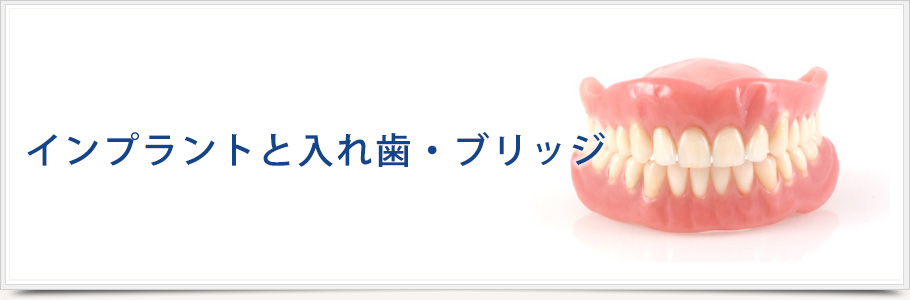 インプラントと入れ歯・ブリッジの比較