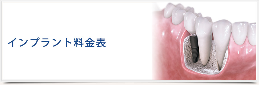 インプラント治療費